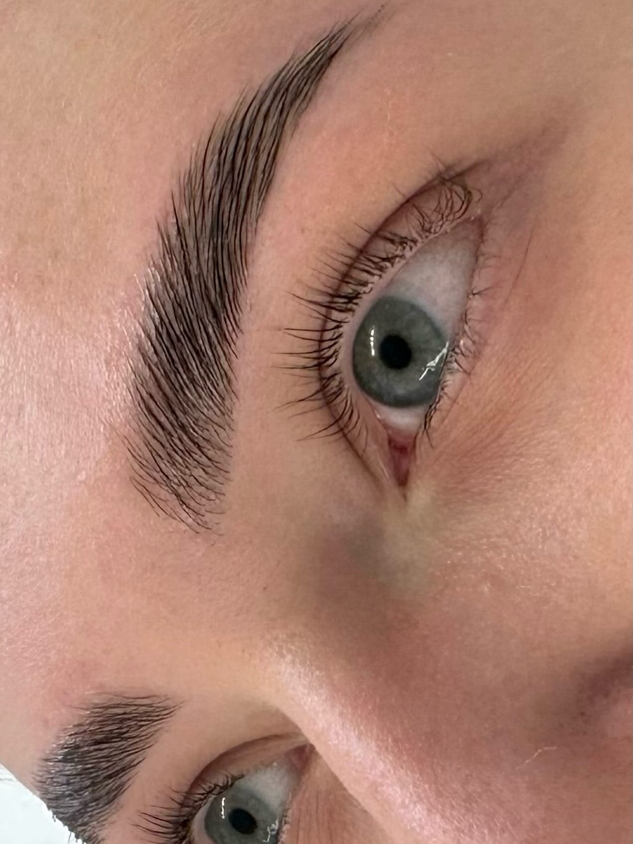 Ergebnis eines professionellen Brow Liftings in Zürich